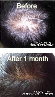 100%Natural Hair Loss Tonic Regrowth Growth Serum 110ml  