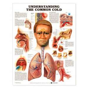 Understanding the Common Cold Anatomical Chart Unmounted  
